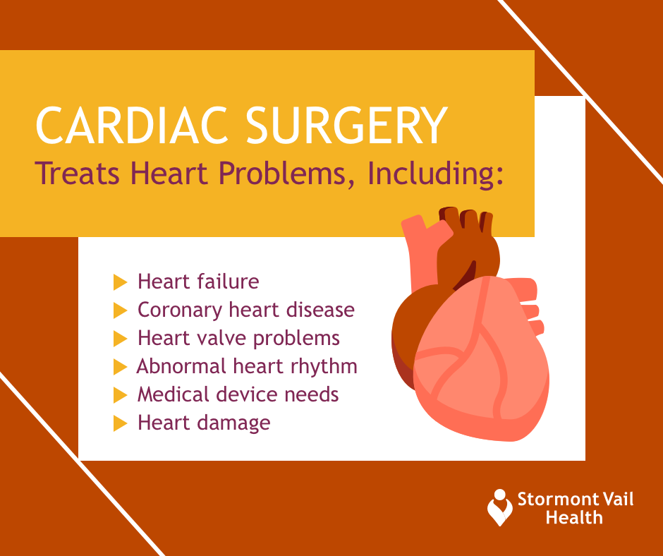Heart Lungs And Veins Cardiothoracic Surgery At Stormont Vail