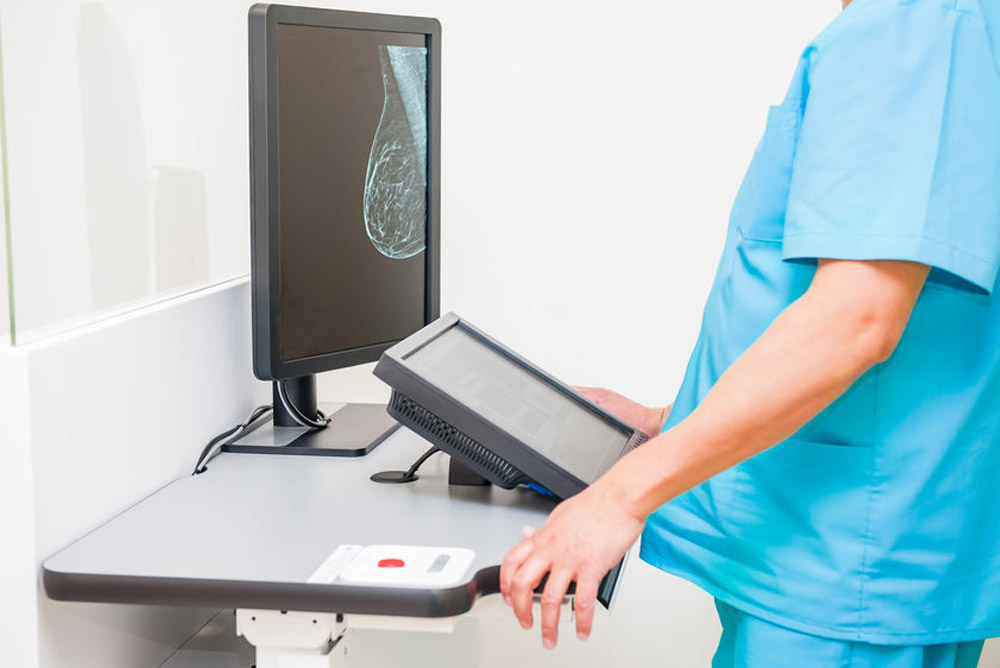 3 Myths About Cancer Screenings for Women
