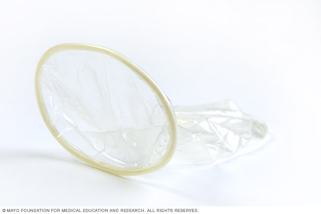 A female condom