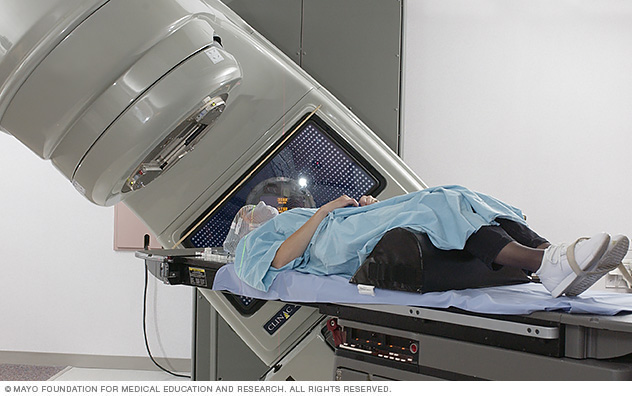 Photo of a person receiving radiation therapy 