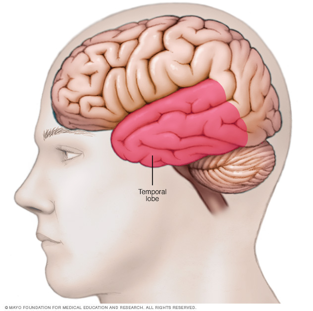 Location of temporal lobe