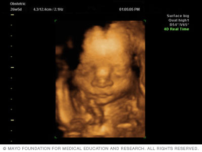 A 3D fetal ultrasound slide showing baby's face