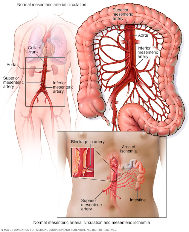 Normal mesenteric arterial circulation and mesenteric ischemia