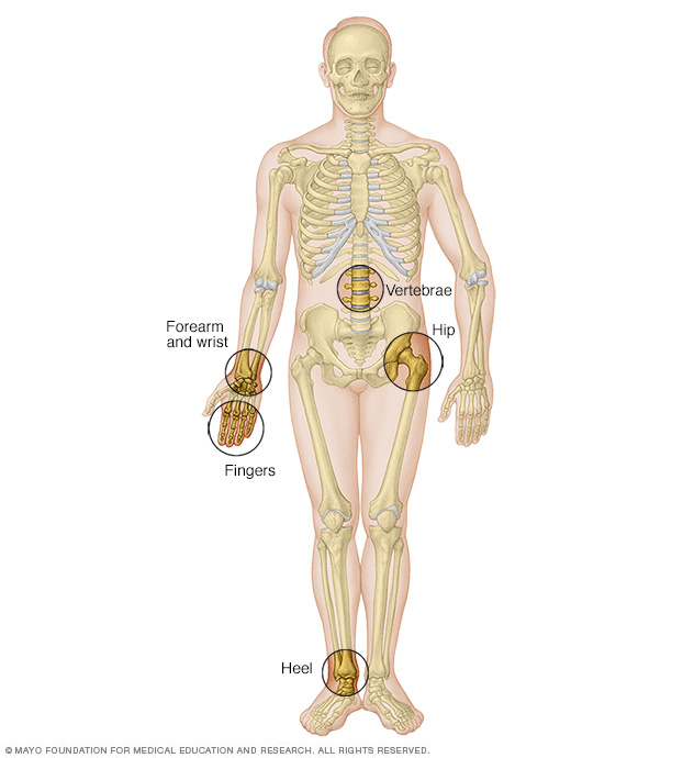 Skeleton and locations for bone density testing