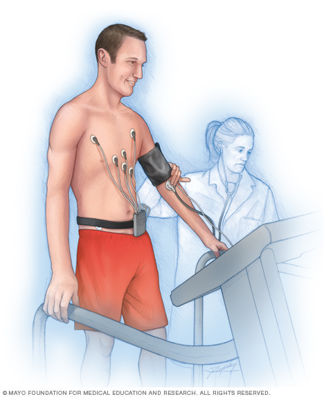 Illustration showing a man performing an exercise stress test
