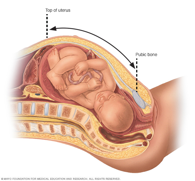 Measurement of fundal height during pregnancy