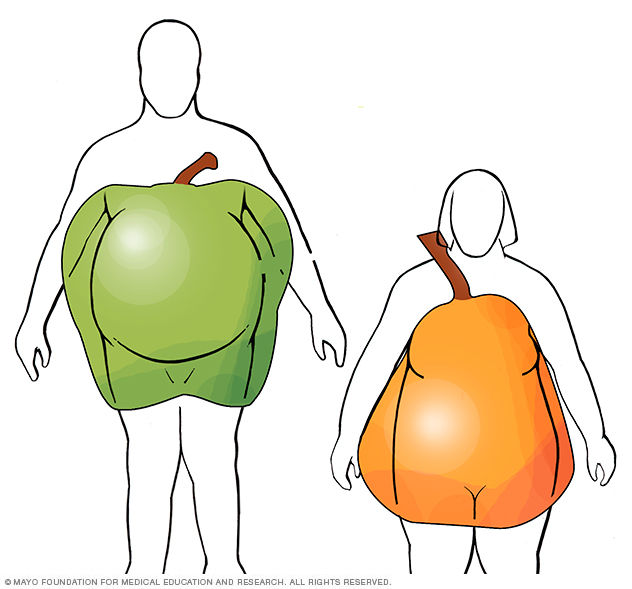 Apple and pear body shapes