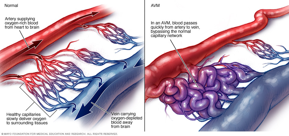 Normal and abnormal blood vessels